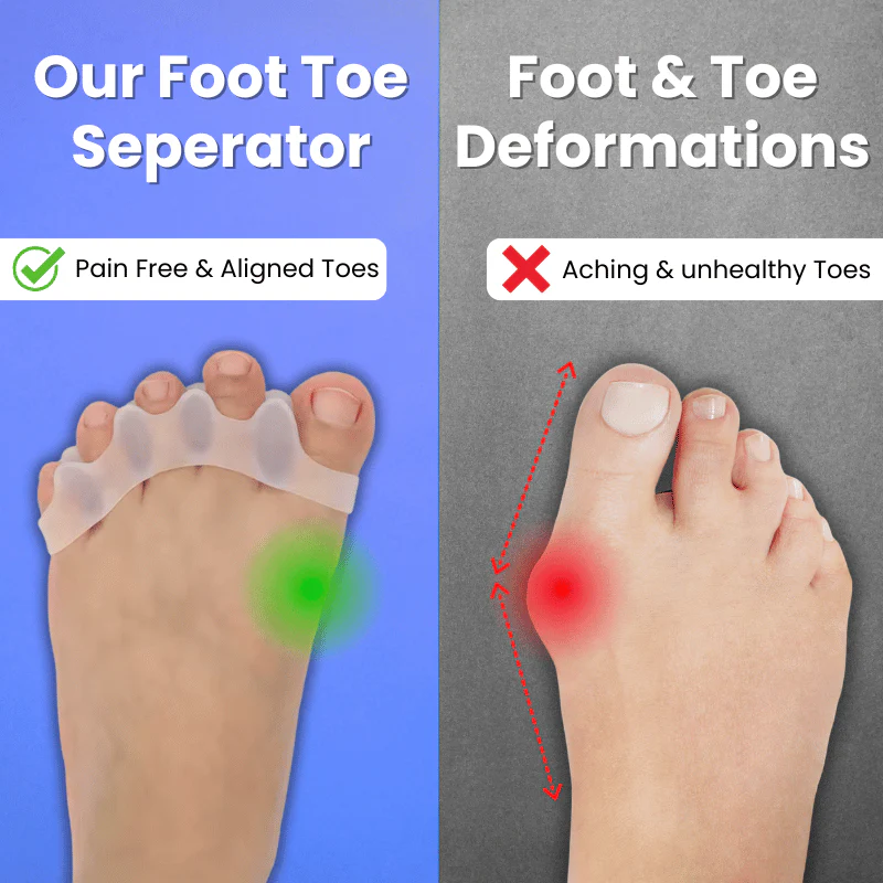 Foot Toe Separator - Correct Bunions & Hammer Toes Naturally – Feel the Relief - Image 3